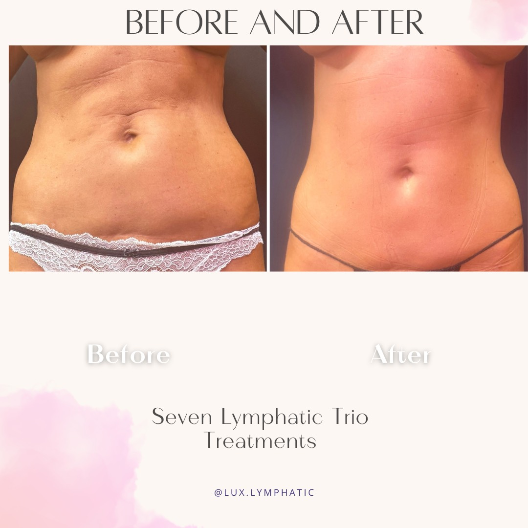 Seven Lymphatic Trio Treatments