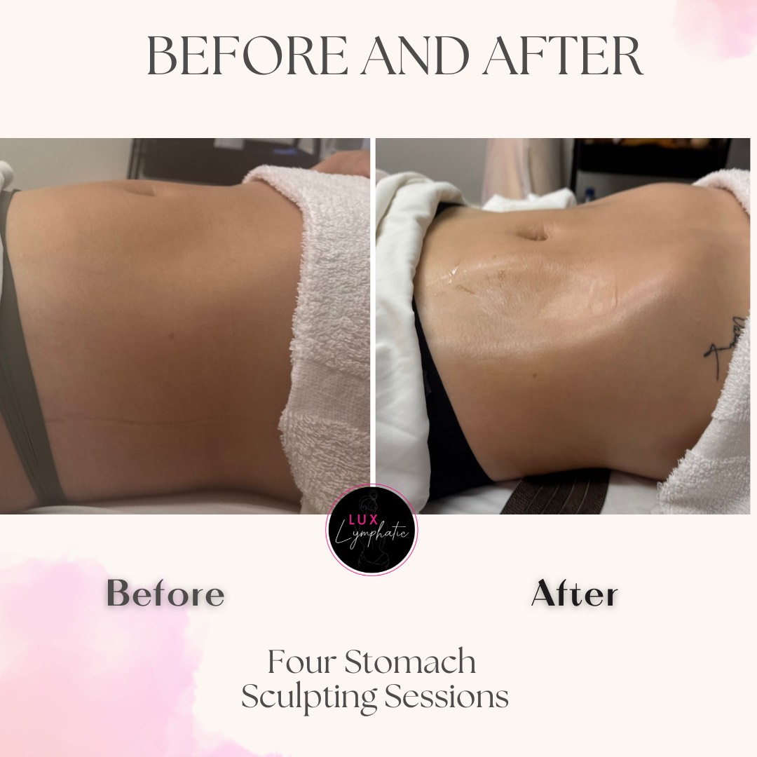 Four Stomach Sculpting Sessions