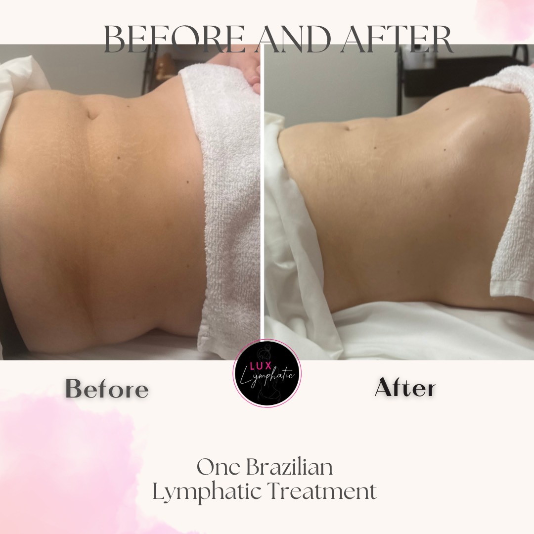 One Lymphatic Massage Session